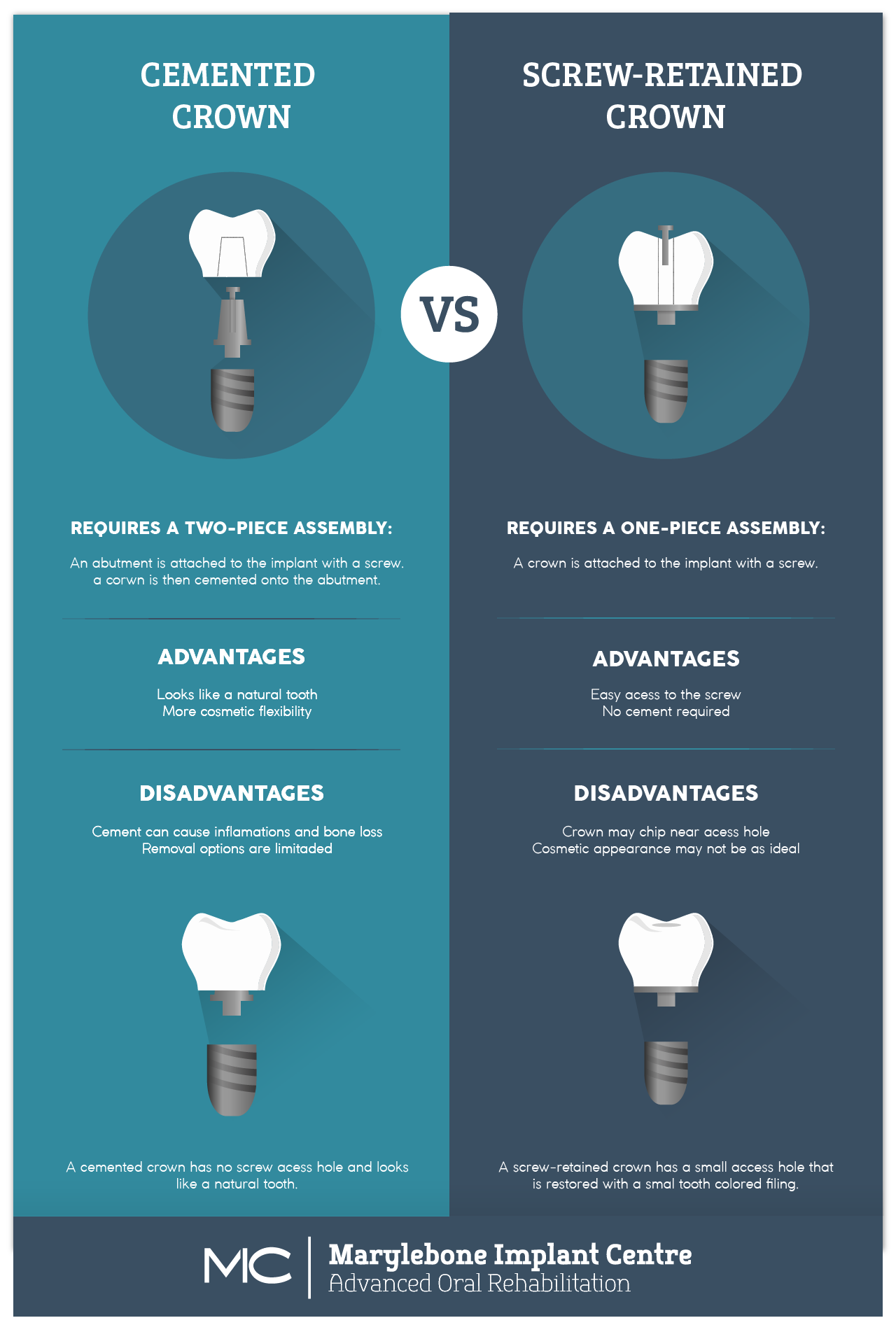 Implant Crowns Infographic